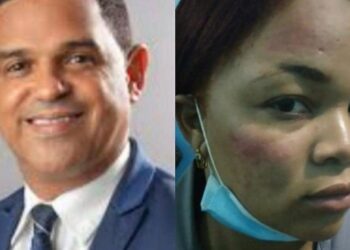 Sadoky Duarte niega maltrato a agente PN