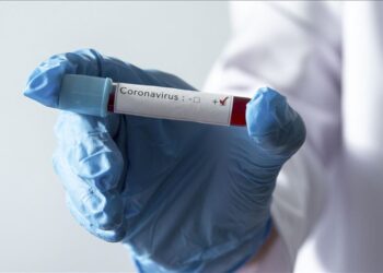 Salud Pública reporta 860 casos nuevos de coronavirus