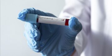 Salud Pública reporta 860 casos nuevos de coronavirus