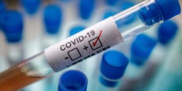Santiago reporta 404 casos nuevos de coronavirus en últimas 24 horas