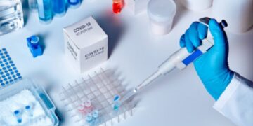 Detectan 1,549 nuevos casos de COVID-19 de 12,141 muestras procesadas en últimas 24 horas