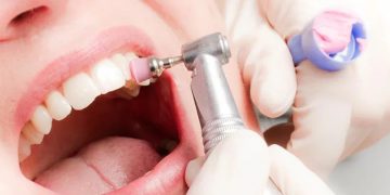 Instan a cuidar las encías para prevenir la pérdida de dientes y otros riesgos para la salud
